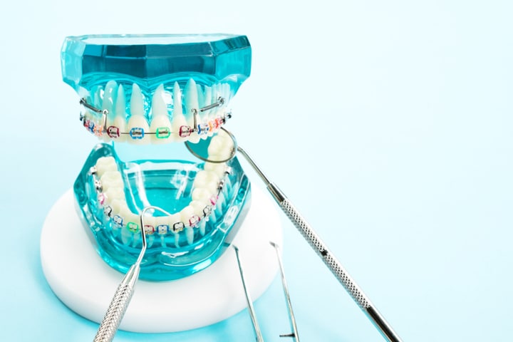 Orthodontics, orthodontist