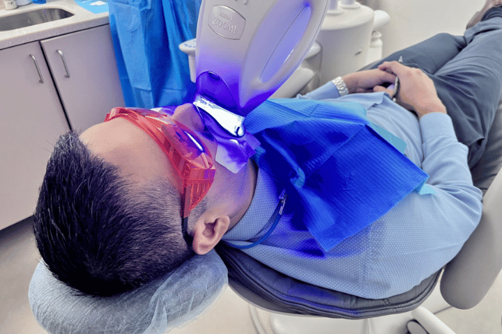 Teeth whitening, zoom technology