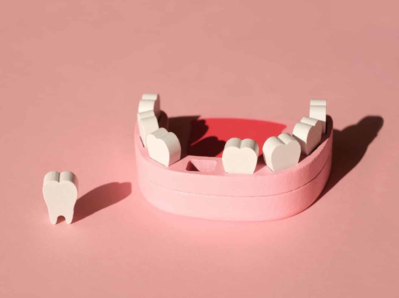 Missing teeth: What are the tooth replacement options | Smilefocus Dentist