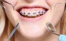 orthodontics-services